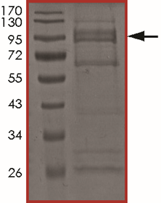 EGFR (d747-749 A750P), Active
